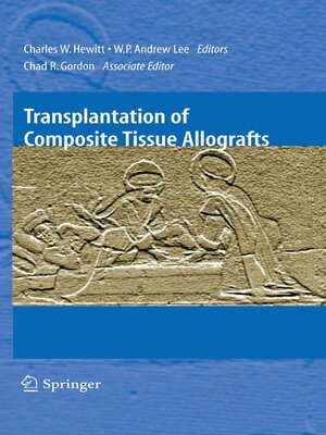cover image of Transplantation of Composite Tissue Allografts